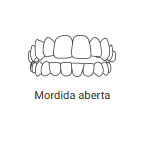 Invisalign Campinas